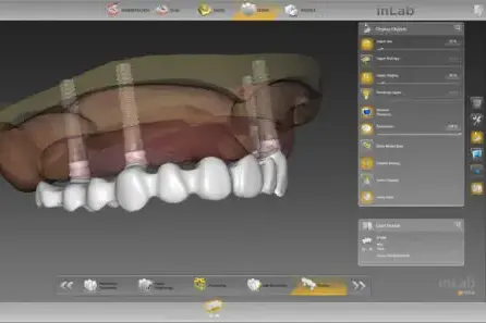 Inlab cad software