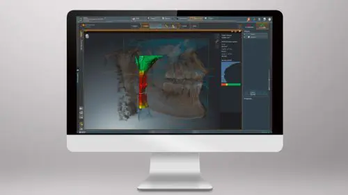 Orthophos S 3D